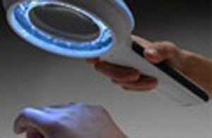 Skinlite Treatment