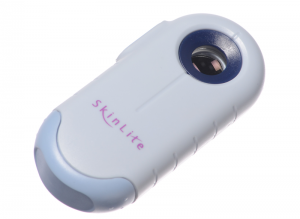 Skinlite treatment
