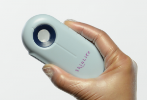 Skinlite treatment
